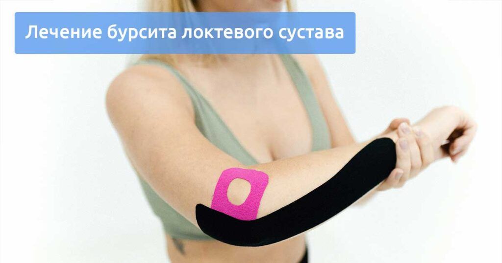 Лечение бурсита локтевого сустава