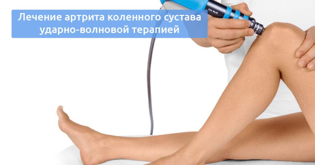 Лечение артрита коленного сустава ударно-волновой терапией УВТ