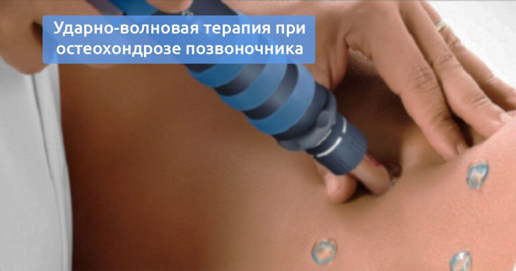 Ударно-волновая терапия при остеохондрозе