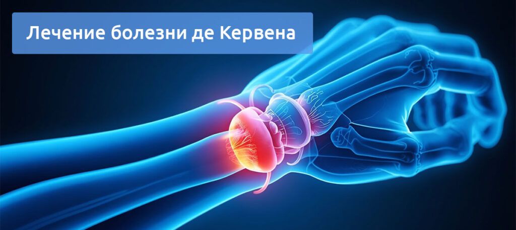 Болезнь де Кервена: от первых симптомов до полного восстановления